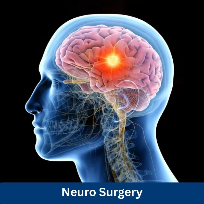 Best Neurosurgeon at Fortis Hospital Delhi