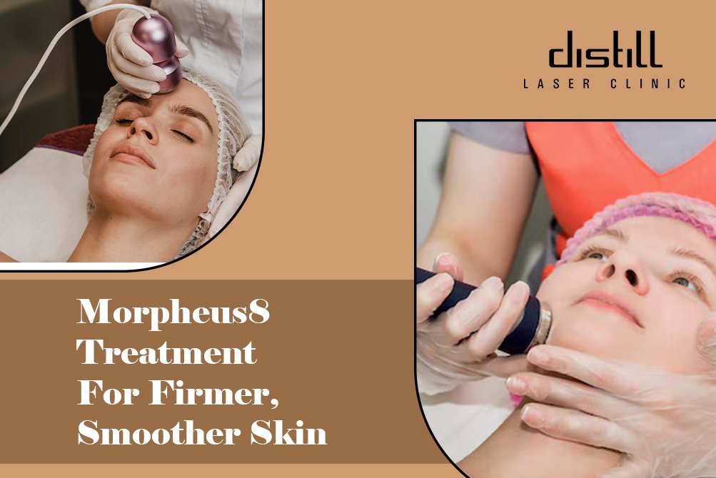Morpheus8 Treatments in Oakville